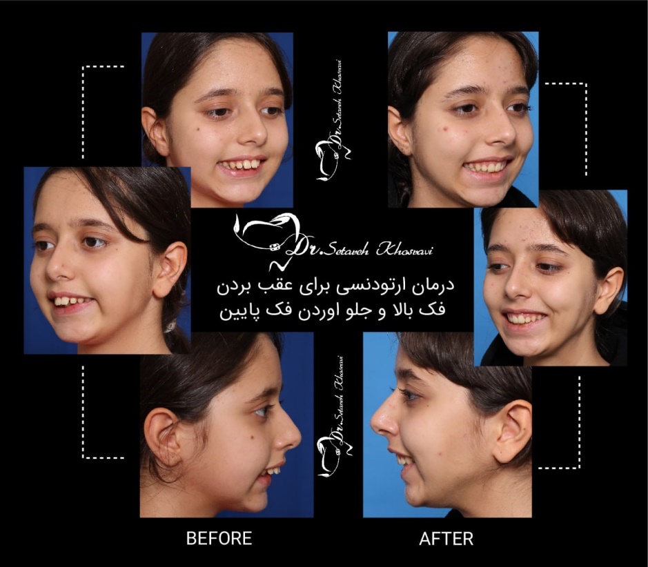 درمان ارتودنسی _ دکتر ستاره خسروی
